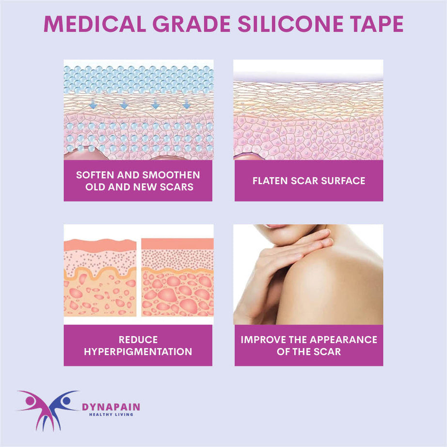 Medical Grade Silicone Scar Sheets, Silicone Scar Strips