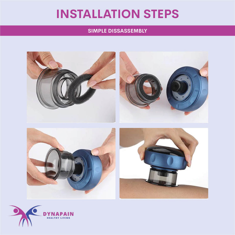 Vacuum Suction Cups For Pain Relief